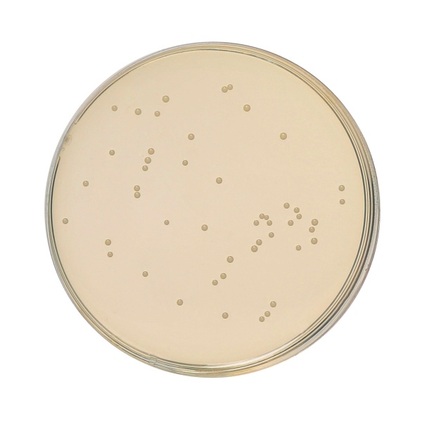 HiEncapâ„¢ Potato Dextrose Agar