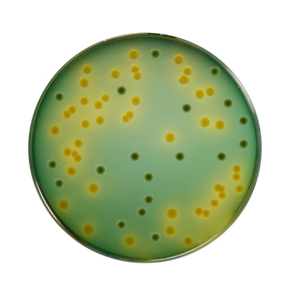 TCBS Agar 100G